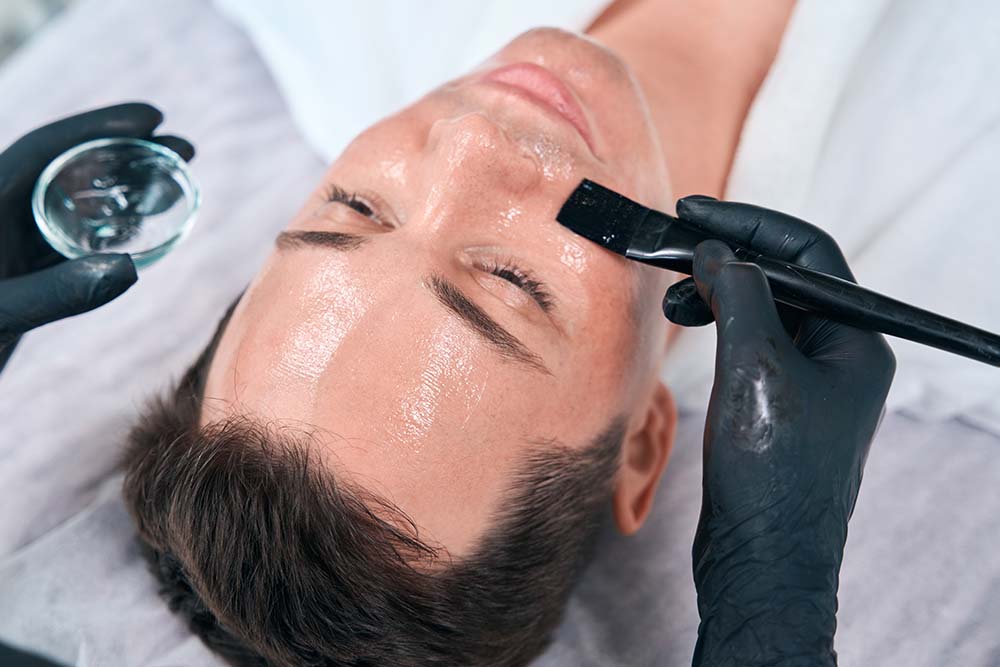 chemical face peel chemical face peel