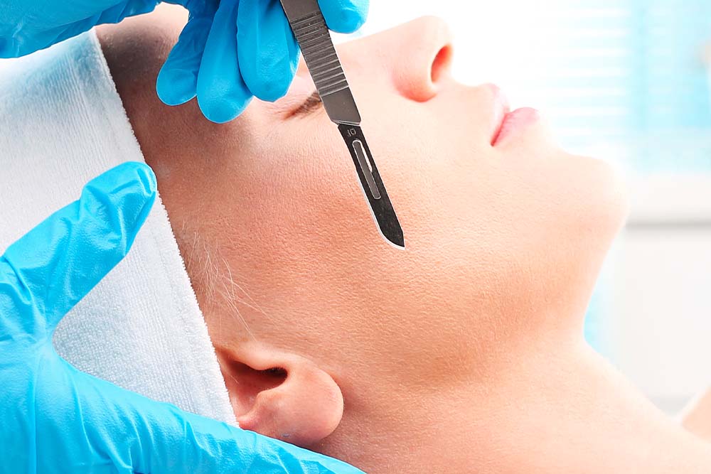dermaplaning facial dermaplaning facial