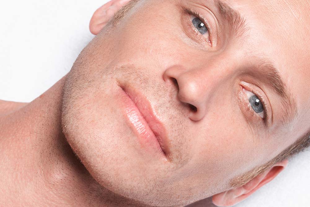 sculptra injections sculptra injections