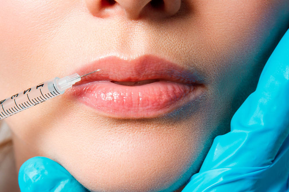 dermal filler treatment dermal filler treatment