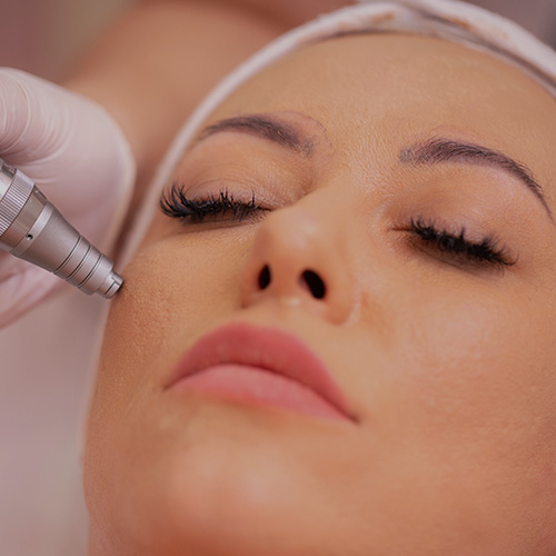 skinpen microneedling