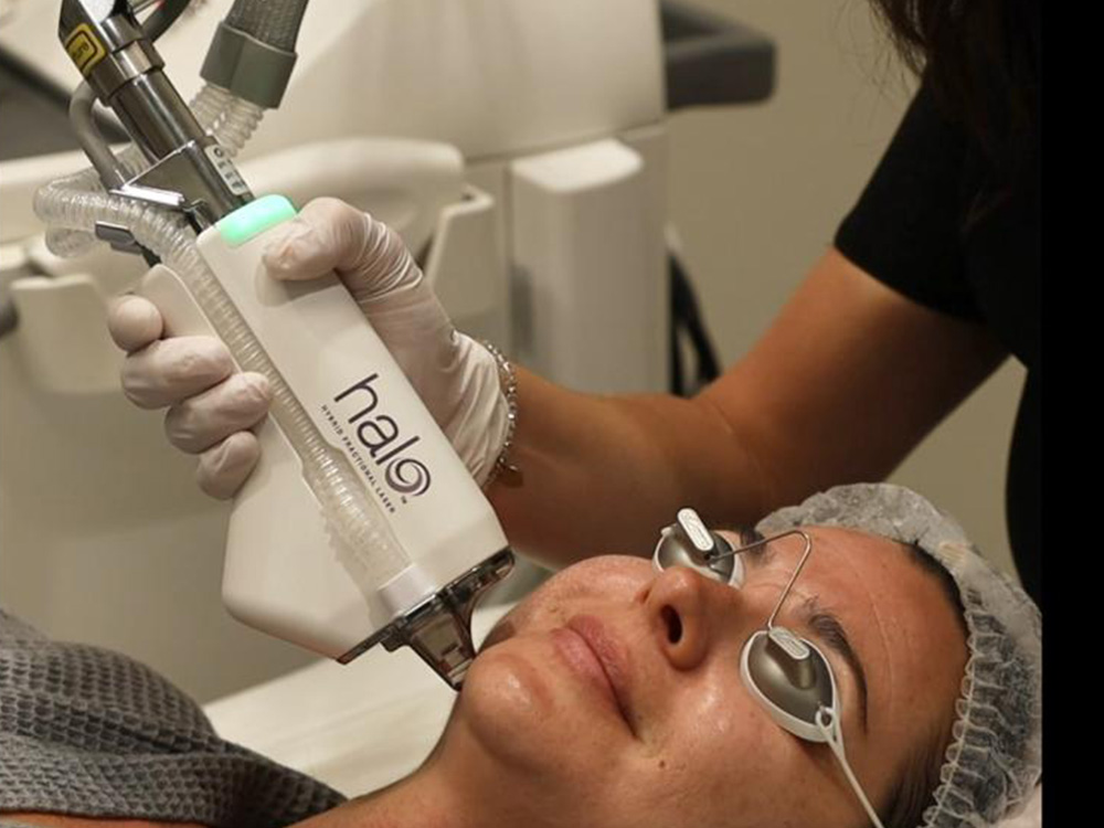halo treatment for acne scarring