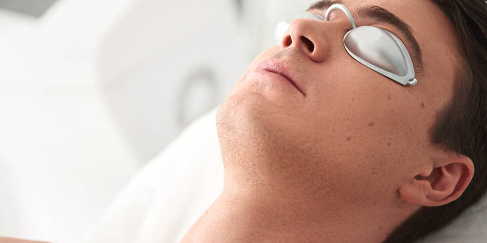 types of laser treatments for face